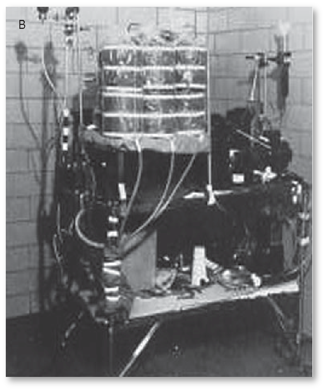 Erster Membranoxygenator