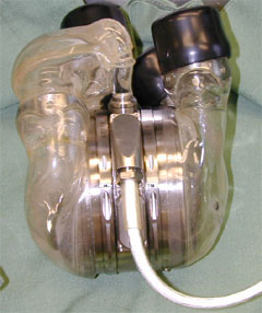 AbioCor